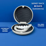 Aufsteckbare Verblendungen – Bild 2